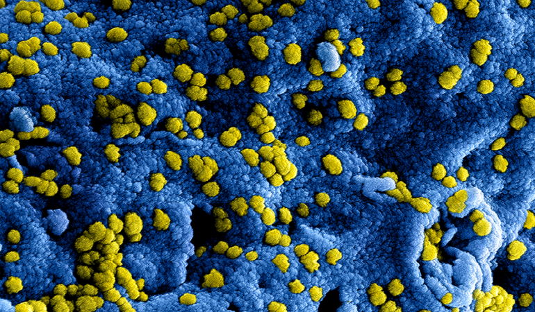 Gratis webinar 'Het coronavirus en werk'