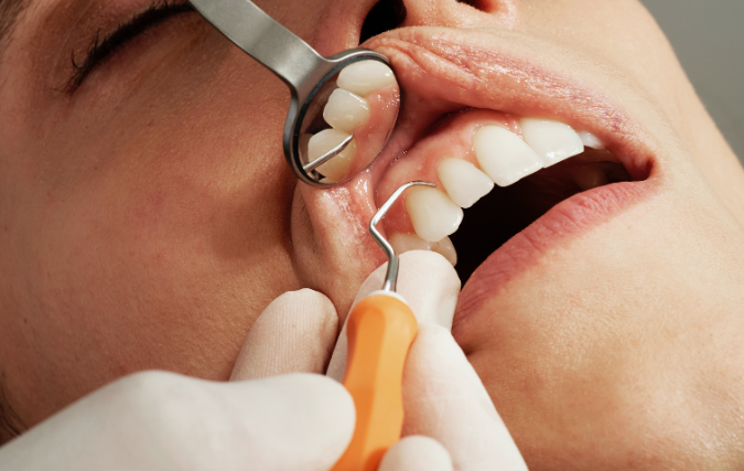 5 belangrijkste nieuwe dentale technologieën