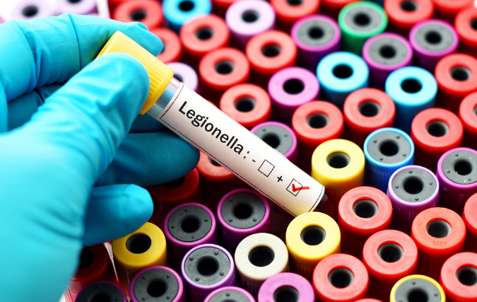 Legionellapreventie: alles wat je moet weten